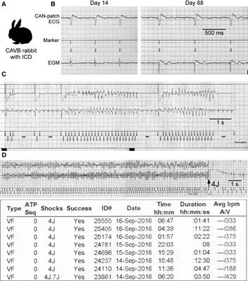 Mechanisms of torsades de pointes: an update